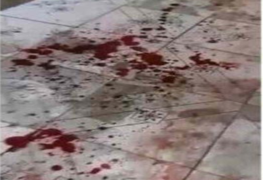 Center sangue