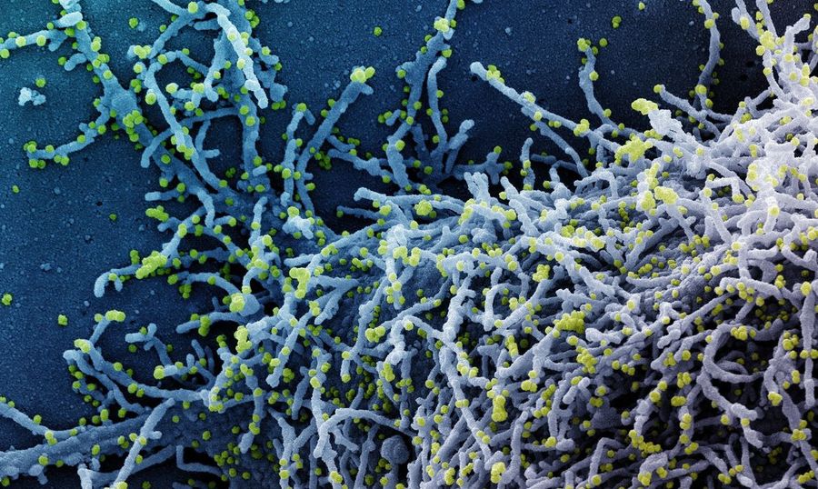Center novo coronavirus sars cov 2270920214120