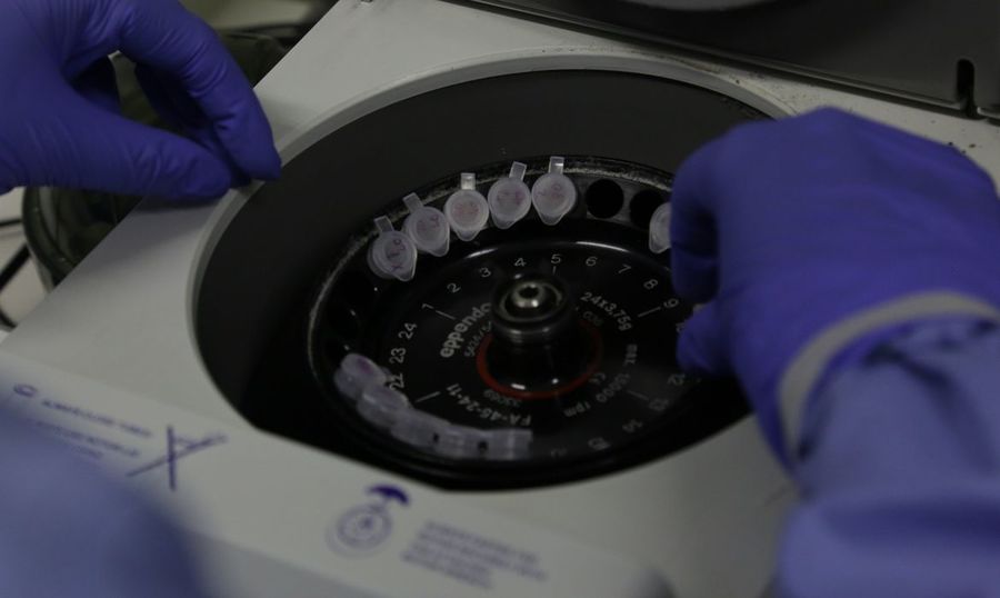 Center diagnostico laboratorial de casos suspeitos do novo coronavirus 2801209408