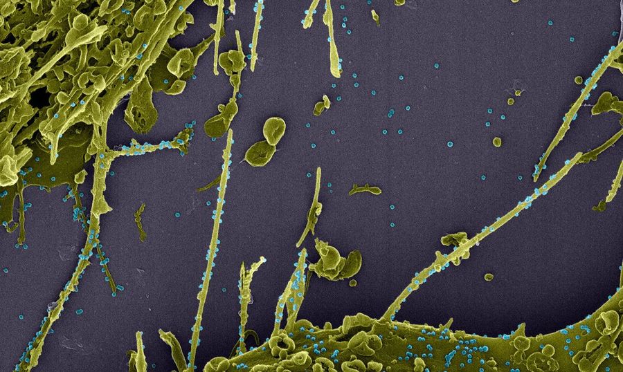 Center coronavirus em acao