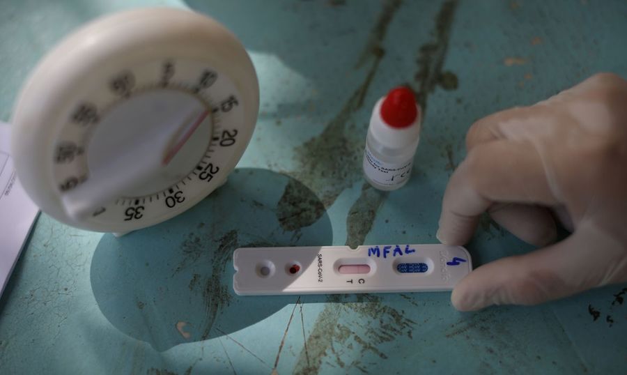 Center coronavirus teste covid 19
