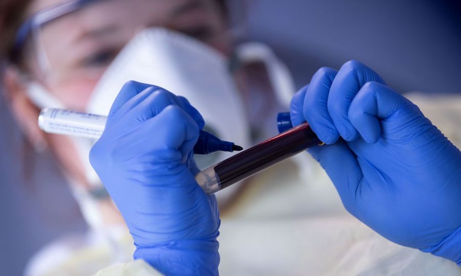 Center 2020 05 19t125619z 1052911345 rc2org9mngt0 rtrmadp 3 health coronavirus rki study