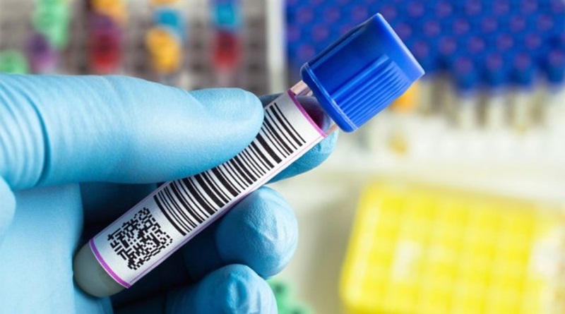 Lab blood vs swab dna testing1
